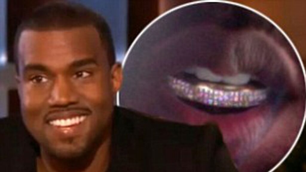 Kanye West's Titanium Teeth and Tumultuous Times Dental Times